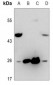 Anti-CD153 Antibody