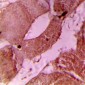 Anti-cTnI (pS22/S23) Antibody