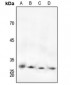 Anti-cTnI (pS22/S23) Antibody