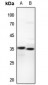 Anti-UCP3 Antibody