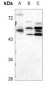 Anti-ULK3 Antibody