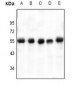 Anti-VASP (pS238) Antibody