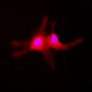 Anti-SGK1 (pS422) Antibody