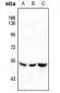 Anti-SGK1 (pS422) Antibody