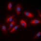 Anti-ACLY Antibody