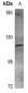 Anti-ACLY Antibody