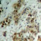 Anti-AKT (pT450) Antibody