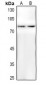 Anti-AKT (pT450) Antibody