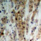 Anti-AKT (pS246) Antibody