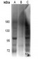 Anti-Androgen Receptor (pS213) Antibody