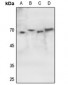 Anti-ATF2 (pS62) Antibody