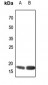 Anti-ATP5H Antibody