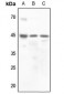 Anti-Vasopressin V2 Receptor Antibody