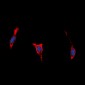 Anti-BAI1 Antibody