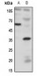 Anti-BDKRB1 Antibody