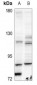 Anti-BMX Antibody