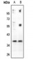 Anti-CD88 Antibody