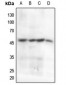 Anti-Cyclin B1 (pS147) Antibody