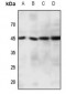Anti-CCR11 Antibody