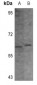Anti-CHK1 (pS296) Antibody