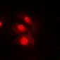 Anti-CHK1 (pS345) Antibody