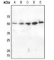 Anti-CHK1 (pS345) Antibody