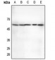 Anti-CHK2 (pT68) Antibody