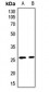 Anti-CLIC3 Antibody