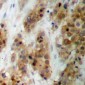 Anti-CMPK1 Antibody