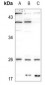 Anti-CMPK1 Antibody