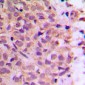Anti-Zeta COP Antibody