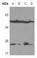 Anti-Zeta COP Antibody