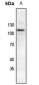 Anti-Catenin delta 1 (pY228) Antibody