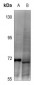 Anti-DDX5 (pY593) Antibody