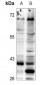 Anti-ELOVL5 Antibody