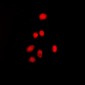 Anti-Estrogen Receptor beta (pS105) Antibody