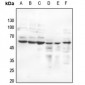 Anti-Estrogen Receptor beta (pS105) Antibody