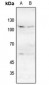 Anti-NMDAR1 (pS896) Antibody
