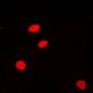 Anti-Histone H2A.Z (AcK5) Antibody