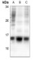Anti-Histone H2A.Z (AcK5) Antibody