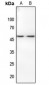 Anti-Histone Deacetylase 3 (pS424) Antibody