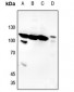Anti-Histone Deacetylase 7 (pS155) Antibody