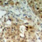 Anti-hnRNP K Antibody