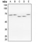 Anti-hnRNP K Antibody