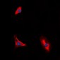 Anti-CD210a Antibody
