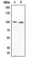 Anti-CD210a Antibody