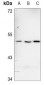 Anti-CD213a1 Antibody