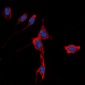 Anti-Kir3.1 Antibody