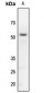 Anti-Kir3.1 Antibody