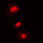 Anti-KIF2C (pS95) Antibody